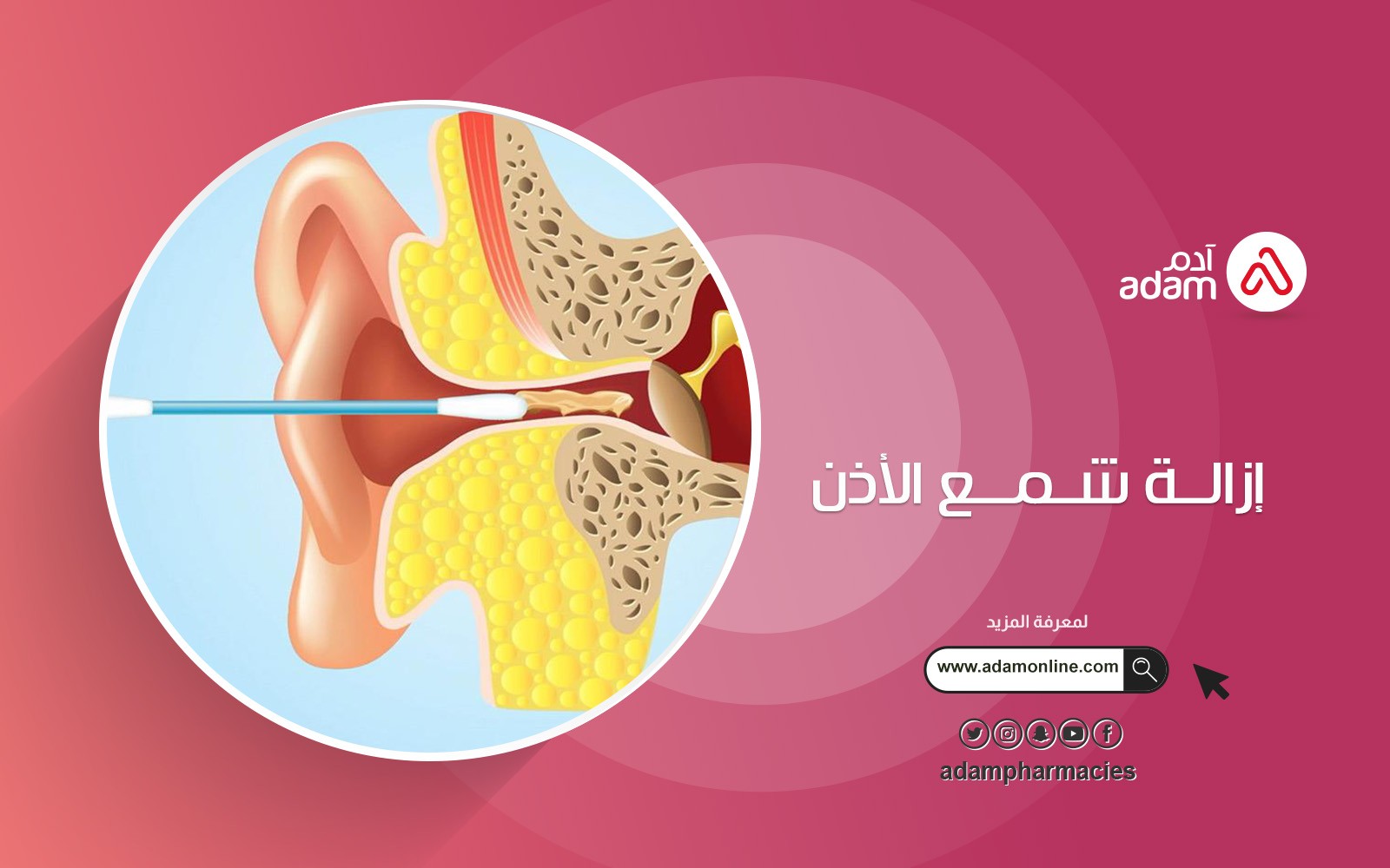 إزالة شمع الأذن